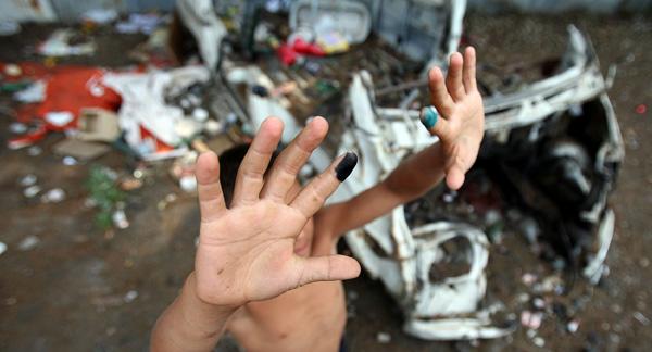 Un enfant rom blessé à Fuorigrotta