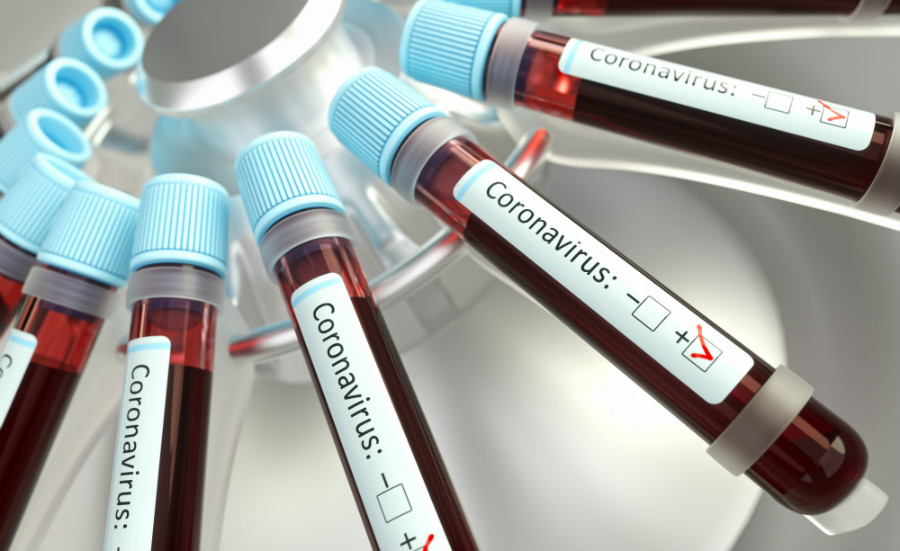 FAQ sul coronavirus, nell'immagine tante provette positive al coronavirus in una centrifuga