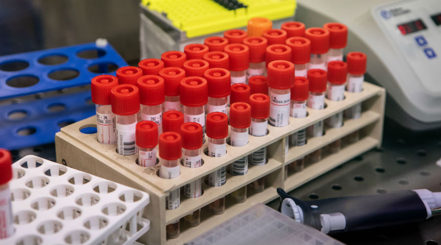 Coronavirus test