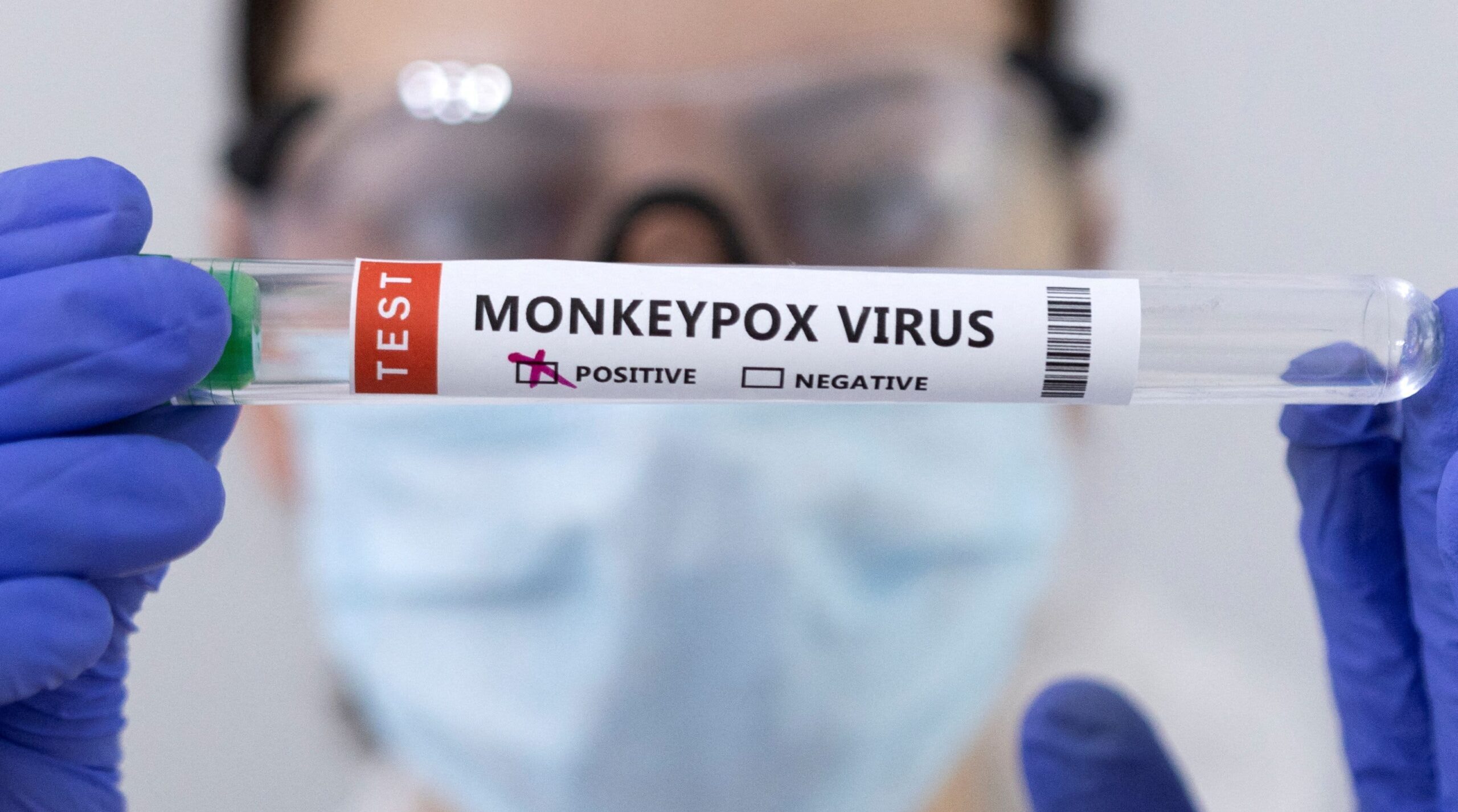 Test for monkeypox