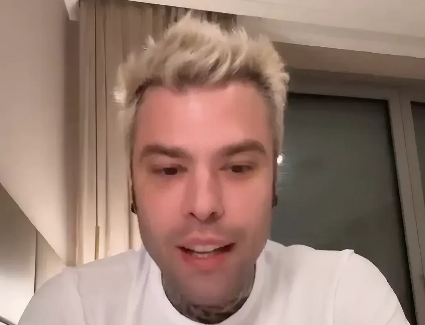 fedez durante la transmisión en vivo en la que explica que problemas tuvo