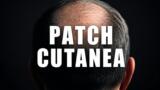 Francesco Facchinetti e la calvizie: «Contro i pochi capelli uso una patch cutanea. Il trapianto? Un male atroce»